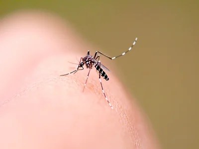 Arboviroses: Secretaria de Saúde anuncia expansão e fortalecimento do suporte hospitalar para pacientes com dengue e&nbsp;chikungunya